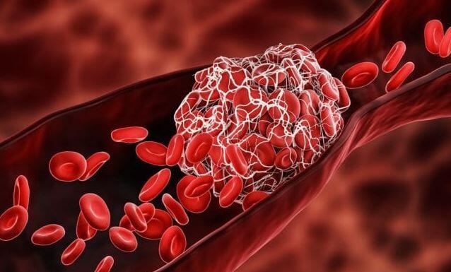 Two Stunning Discoveries Found In Blood Clots From Those Given C