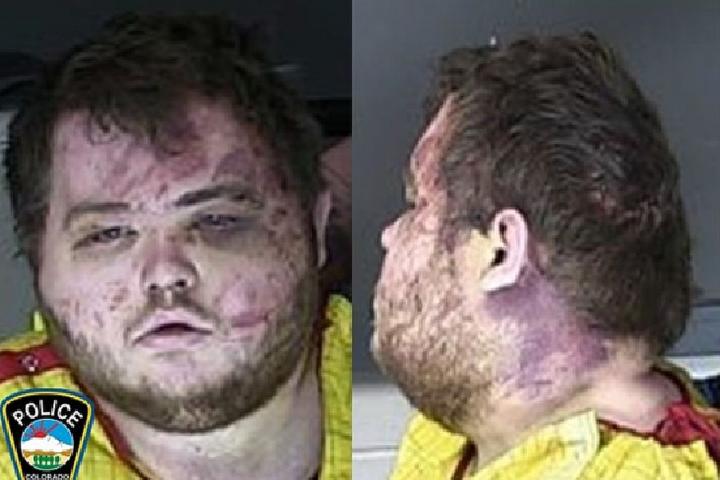 Colorado Shooting Suspect's Mugshot Released, Can Barely Speak a
